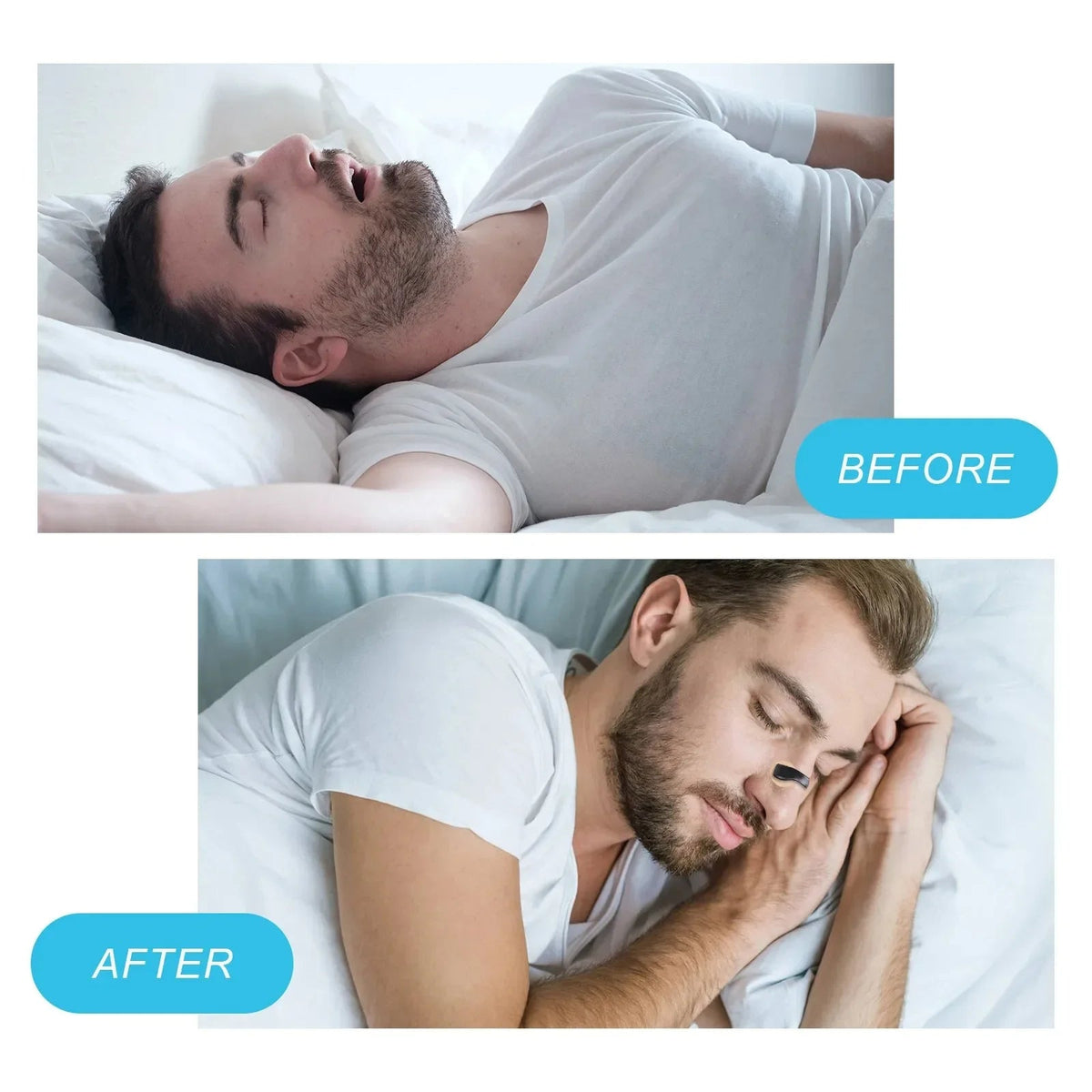 50% OFF Magnetic Nasal Strips