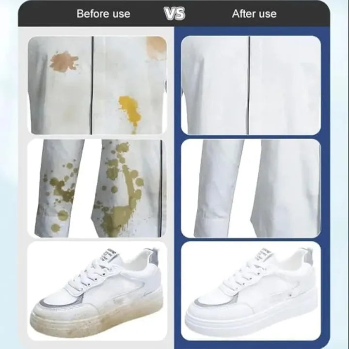 Clothes Stain Removal Wipes | Pack of 40