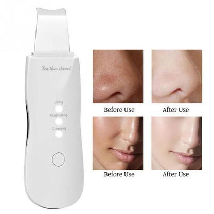 Rechargeable facial skin
