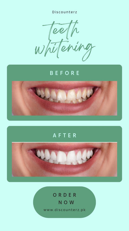 Teeth Whitening Powder