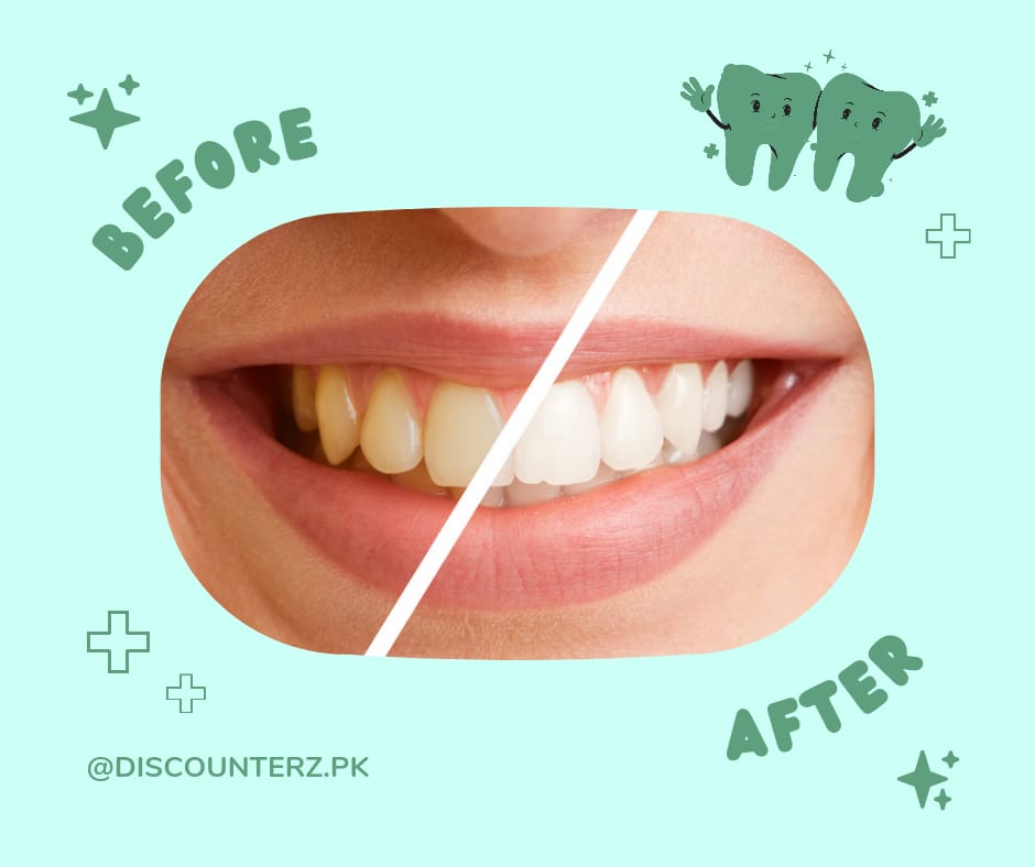 Teeth Whitening Powder